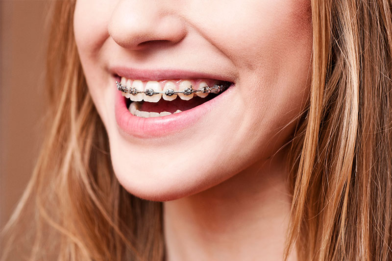 Orthodontics in Clovis